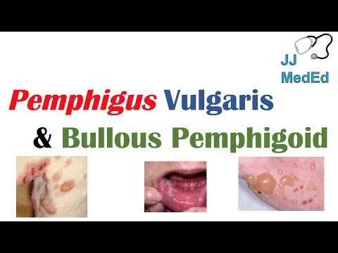 Vesiculobullous Skin Diseases | Pemphigus Vulgaris vs. Bullous Pemphigoid