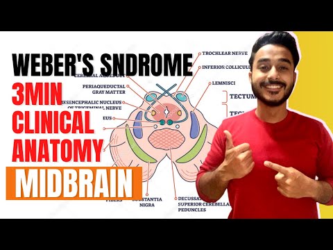 midbrain clinical anatomy | Benedikt's and weber syndrome anatomy | clinical anatomy of midbrain