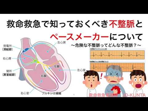 ペースメーカーについて詳しく解説