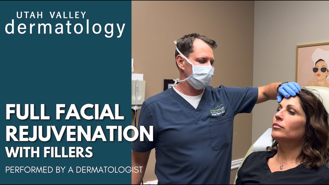 Full Facial Rejuvenation With Fillers | Utah Valley Dermatology
