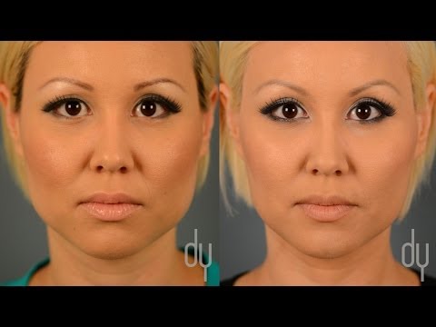 BOTOX®（ボトックス）による咬合器の縮小前・縮小後・顎縮小・テーパリングの口コミ - ビバリーヒルズ (BOTOX® for Masseter Reduction | Before + After | Jaw Reduction + Tapering Reviews - Beverly Hills)