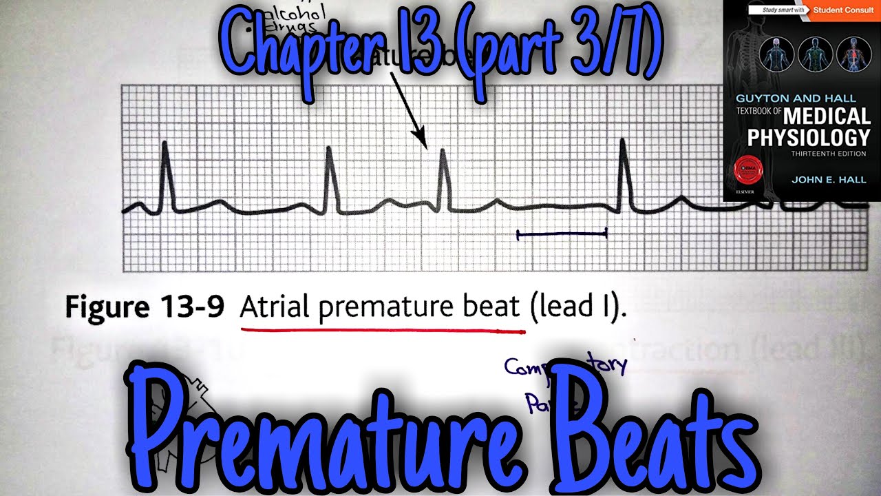 Premature contractions - chapter 13 (part 3/7) - Guyton and Hall text book of physiology.