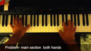 Problem- Main Section Both Hands