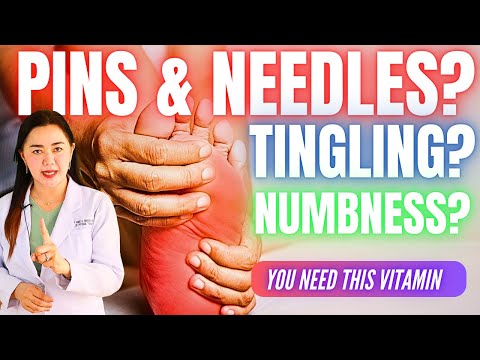 The BEST VITAMIN for Your NERVES (NUMBNESS, TINGLING, PINS and NEEDLES SENSATION) Doc Cherry