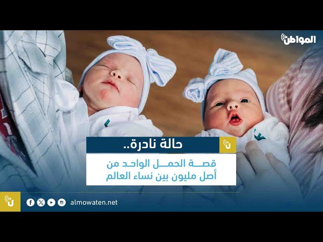 حالة نادرة.. قصة الحمل الواحد من أصل مليون بين نساء العالم