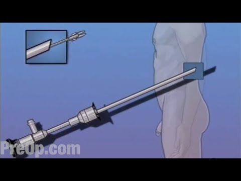 PreOp ® Cystoscopy Male