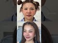 20 วันเท่านั้น‼️ แต่หน้าป้าน้องแอลเปลี่ยนมาก