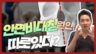 안면비대칭, 왜 생길까? 교정이 필요한 기준과 윤곽수술의 한계ㅣ비티성형외과