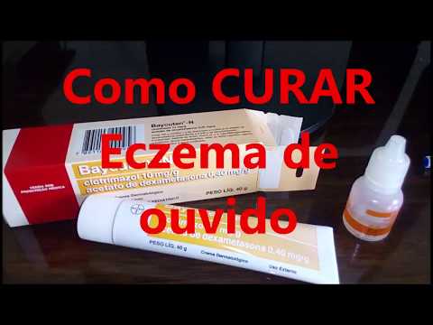 Tratamento de psoríase de unguento da China Tratamento de eczema em nata de mãos