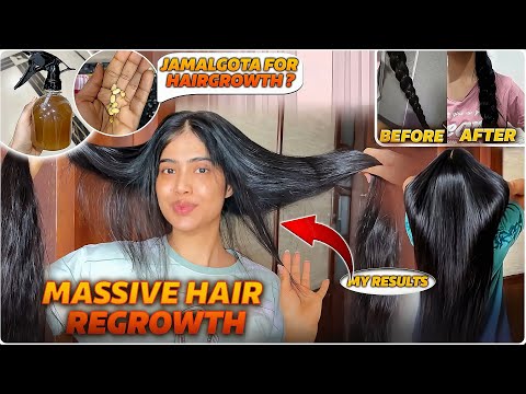 My Ultimate Hair Regrowth Routine | 1.5 Years of Tried & Tested visible Results  *not sponsored*