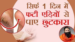 सिर्फ 1 दिन में फटी एड़ियों (Cracked Heels) से पाए छुटकारा | Swami Ramdev