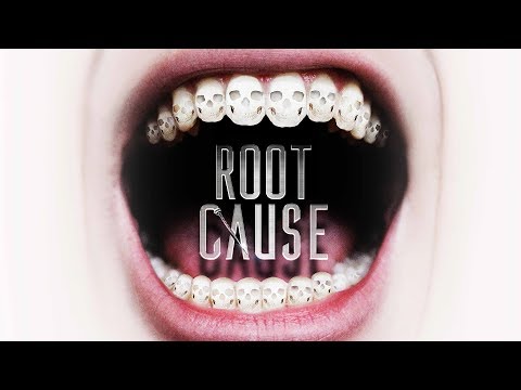 afbeelding Root Cause