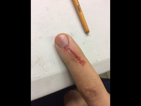YouTube video