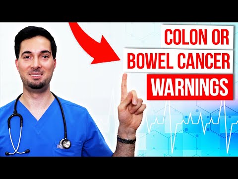 Colon cancer symptoms and signs of bowel cancer