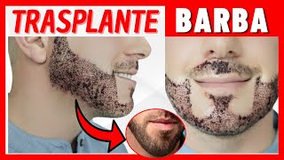 🧔 LO QUE NADIE TE HA CONTADO DEL TRANSPLANTE DE BARBA 🧔