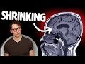 Half Of Us Are Deficient In This Mineral And Its Shrinking Our Brain