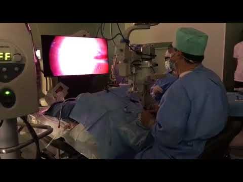 chirurgie oculară în 100 de viziuni