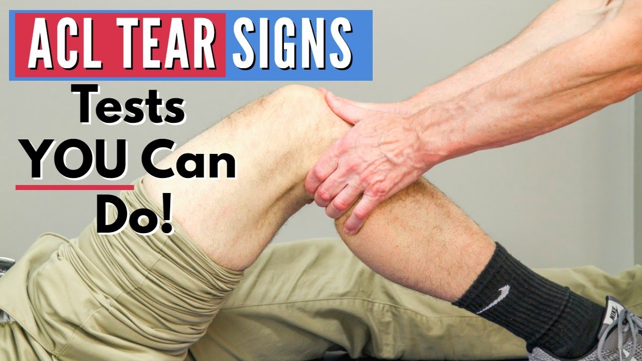 Top 3 Signs You Have an ACL tear (Tests You Can Do At Home)
