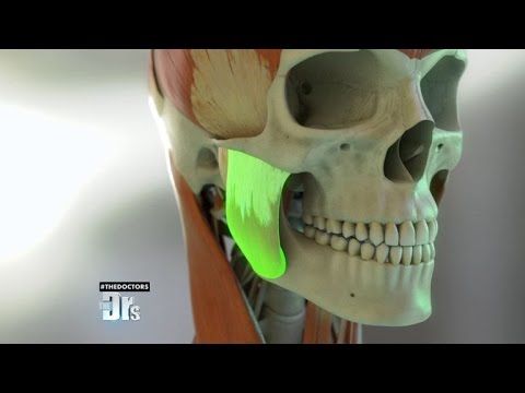 Can Botox Help Cure Teeth Grinding?