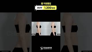 어깨 깎은 줄… 팔 지방흡입 효과 
