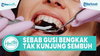 Download lagu Mengenal Gusi Bengkak Tak Kunjung Sembuh hingga Picu Komplikasi, Simak Ulasan drg. Anastasia mp3