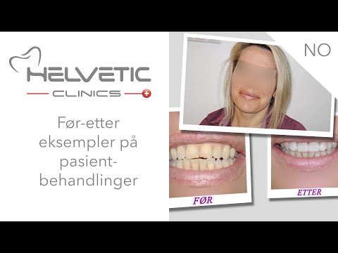 youtube-video-thumbnail