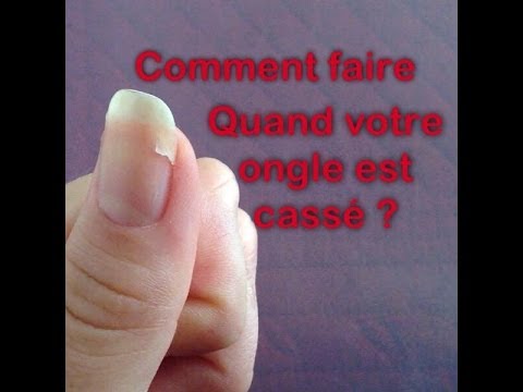 comment reparer ongle fendu