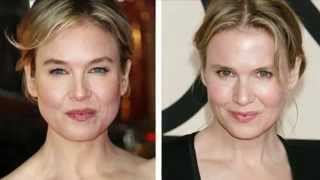 The Good Doctor - What Renée Zellweger Did Wrong with Her Face