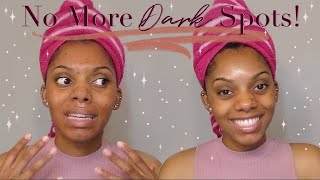 CHEAP & EASY way to get rid of DARK SPOTS || The Secret to Clear Even Skin