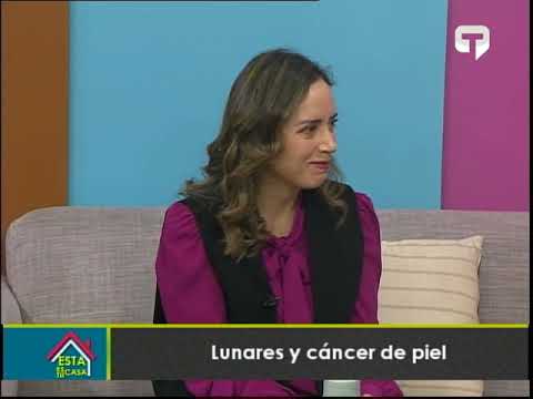 Lunares y cáncer de piel