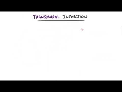 ECG SERIES EP 8 : Cardiac Infarction & Ischaemia
