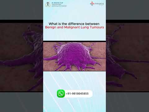 Difference between benign and malignant lung tumors #ytshorts #thoracicsurgery #trendingshorts