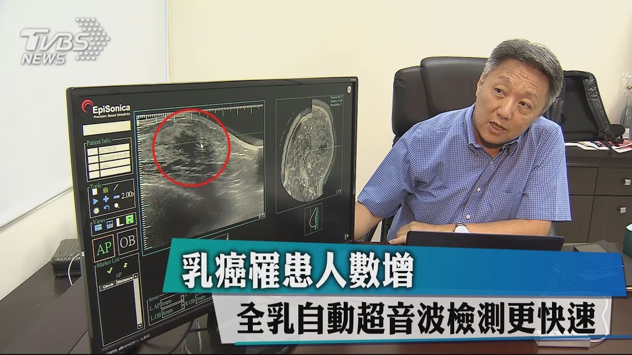 乳癌罹患人數增 全乳自動超音波檢測更快速