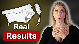CurrentBody LED Neck Mask Review: 8 Weeks of Results on Mature Skin | Doctor Anne