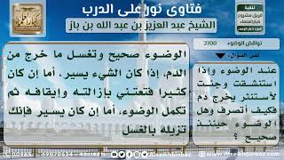 2700 - حكم خروج دم عند الاستنثار من الوضوء - نور على الدرب image