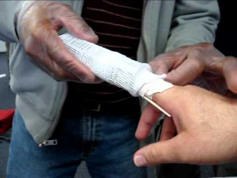 Finger splint