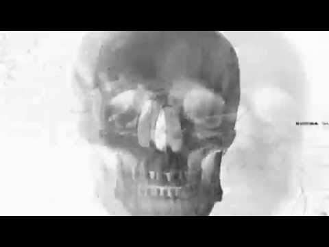 Anacryptic - Tedious Falsehood (Official Video)