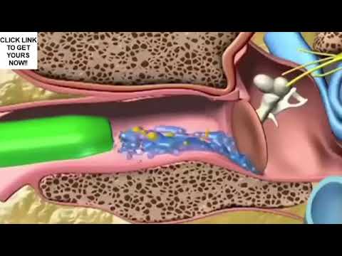 1x oder 2x vibrierender Mini-Staubsauger für Ohrenschmalz - Second Medium