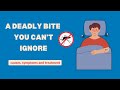 Dengue Fever Symptoms You Should NEVER Ignore Dengue