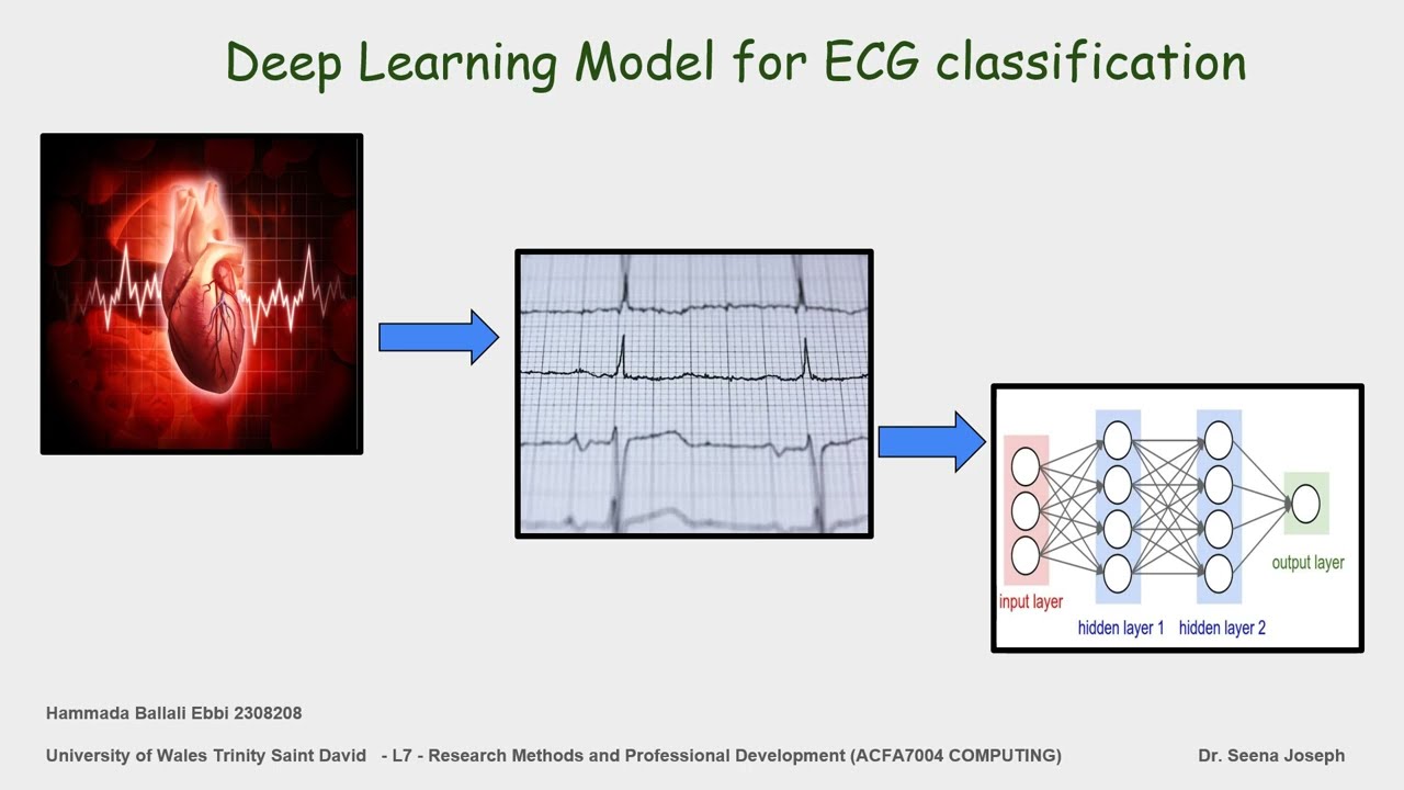 Deep Learning Model for ECG classification