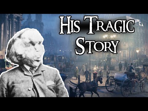 The Curious Case of The "Elephant Man" | Joseph Merrick