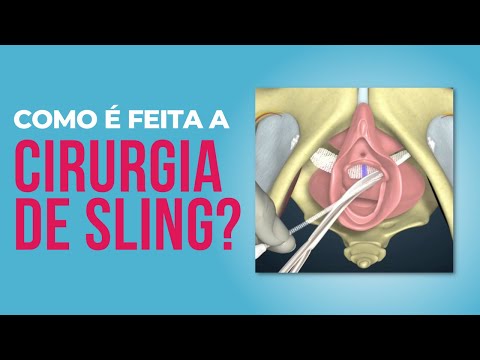 Como é feita a cirurgia de sling?