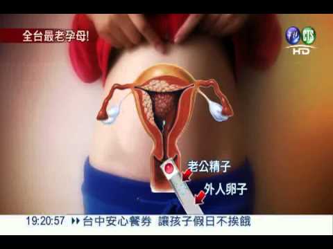 讓子宮回春! 62歲婦人產下雙胞胎