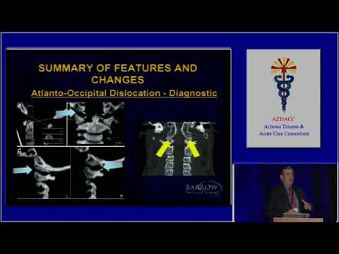 Management of Acute Spinal Cord Injuries