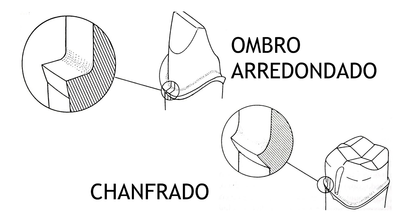 Tipos de término cervical