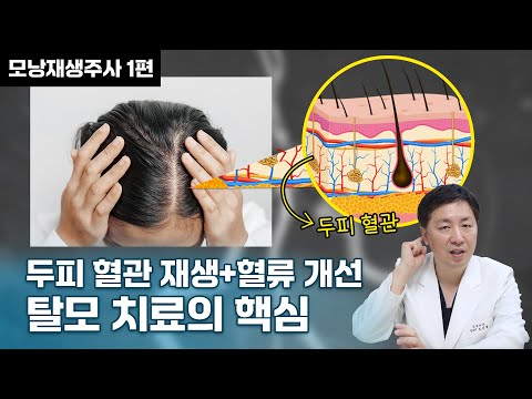 탈모치료의 핵심은 두피 혈관 재생 및 혈류 개선