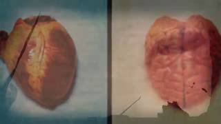 The Books ║ We Bought The Flood (COVER)