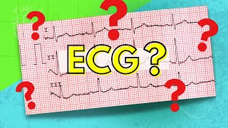 048 How to Read an Electrocardiogram (ECG/EKG)