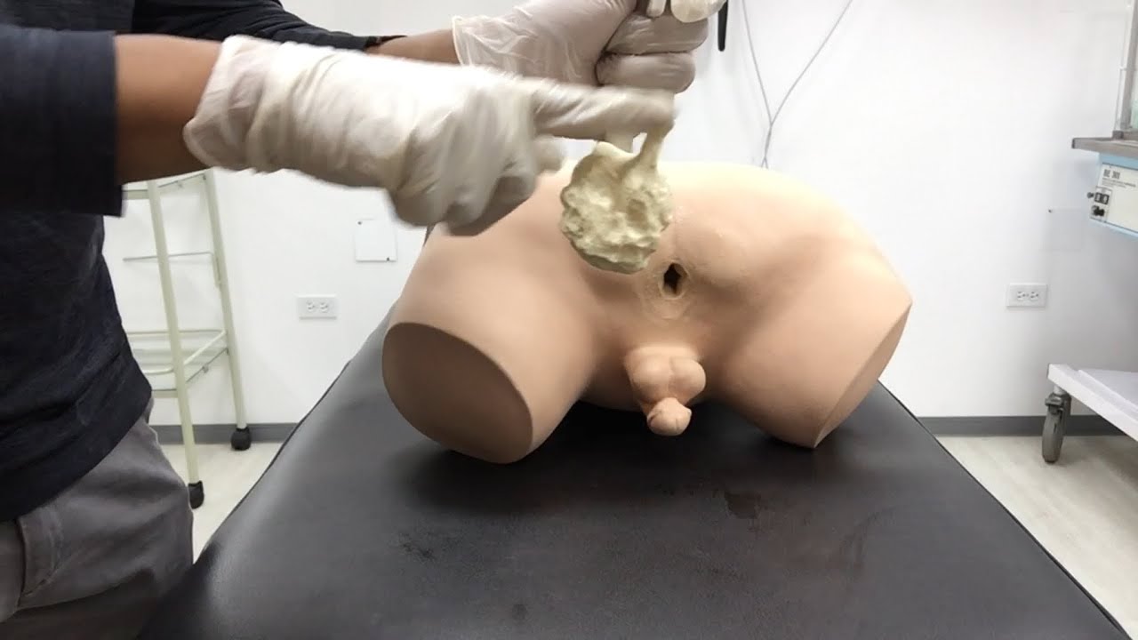 Watch Tacto rectal TEORÍA y PRÁCTICA Now Tacto rectal TEORÍA y PRÁCTICA