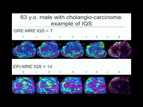 5th Annual TMII Symposium - 2015 - Session IV - Cancer & Body Imaging